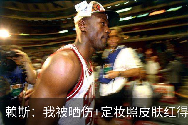 赖斯：我被晒伤+定妆照皮肤红得发亮，我妈快把我骂死了
